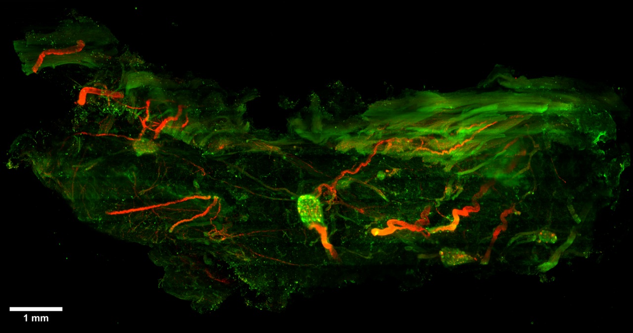 Imaging Of Gps The Brains On The Heart Surface